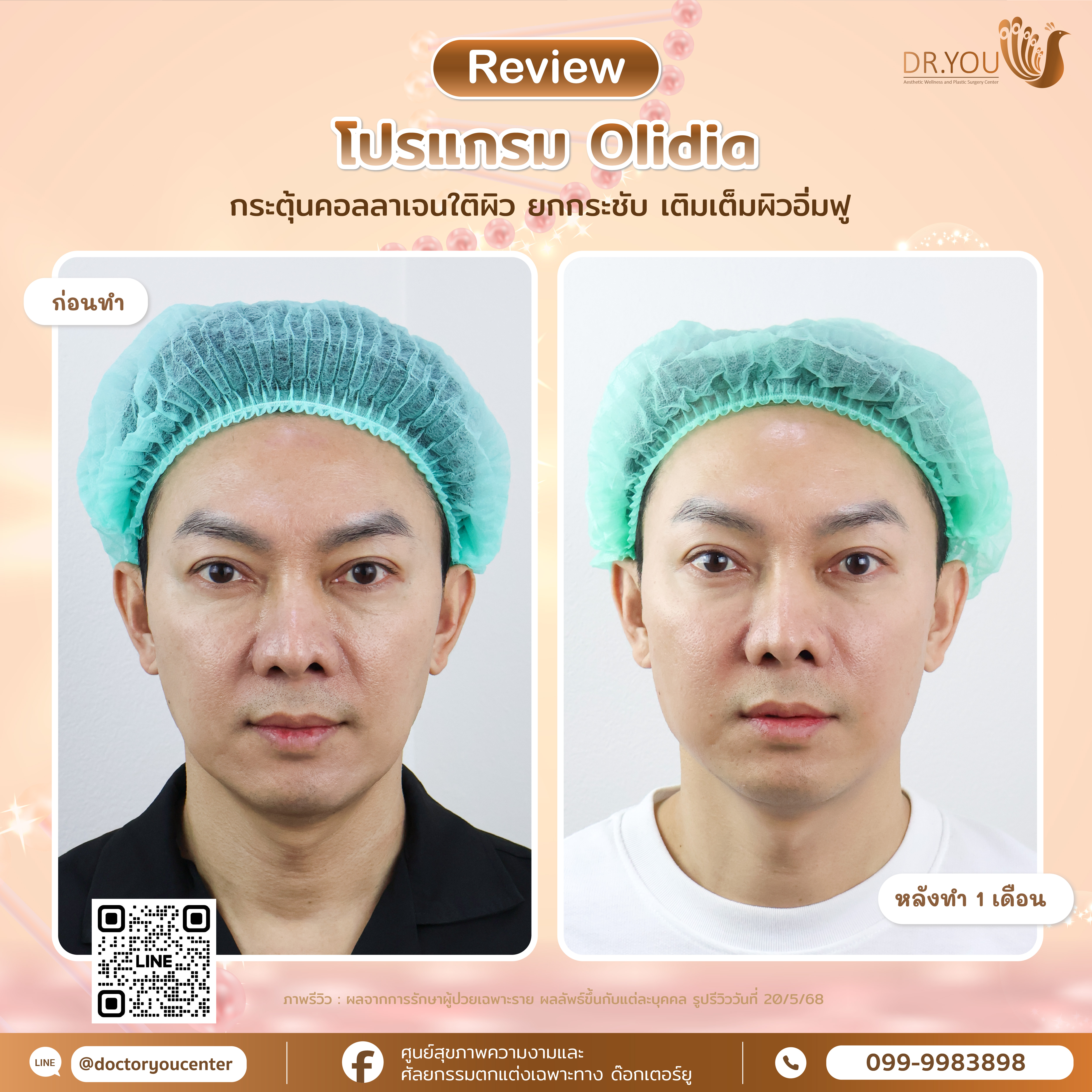 รีวิว Olidia