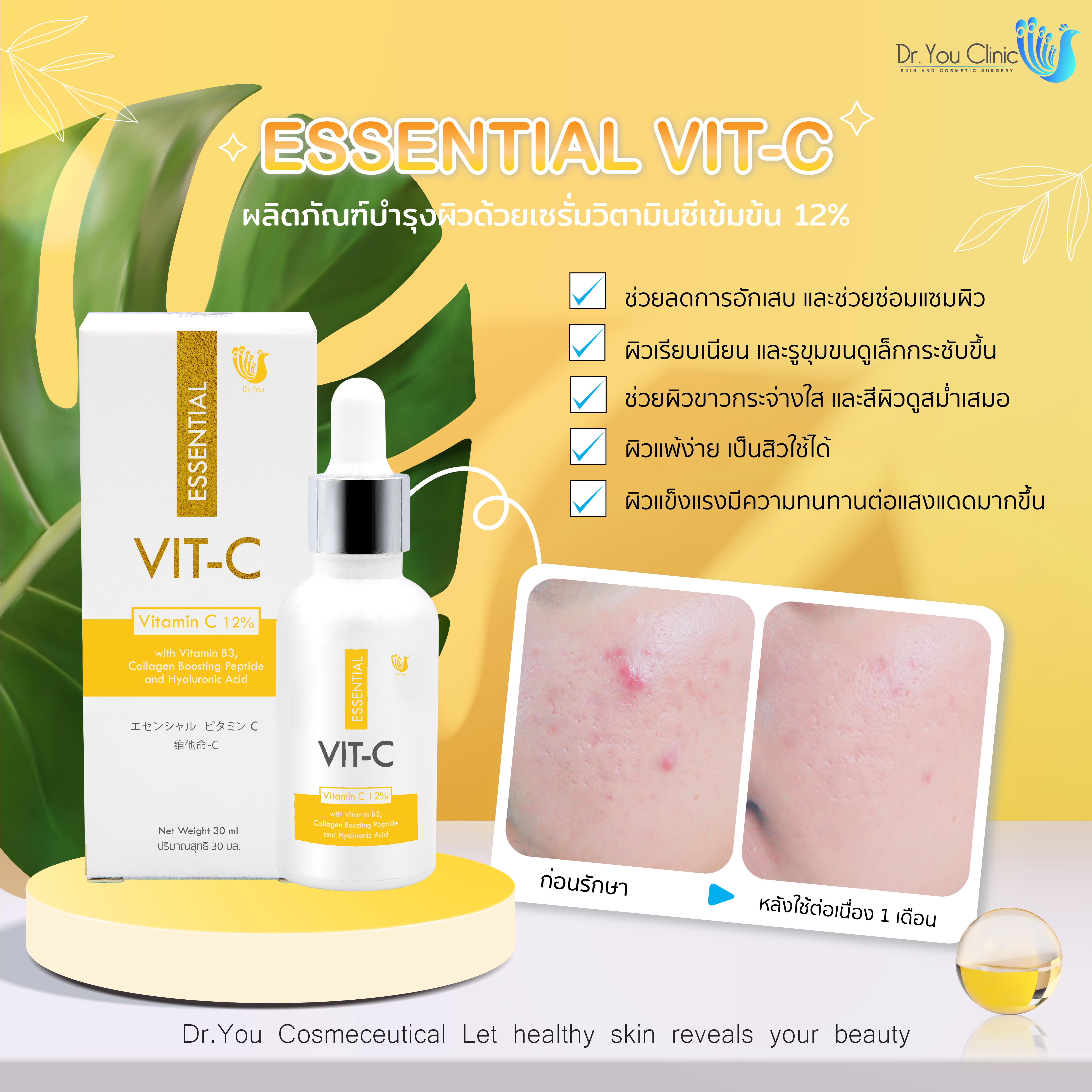 ESSENTIAL VIT-C