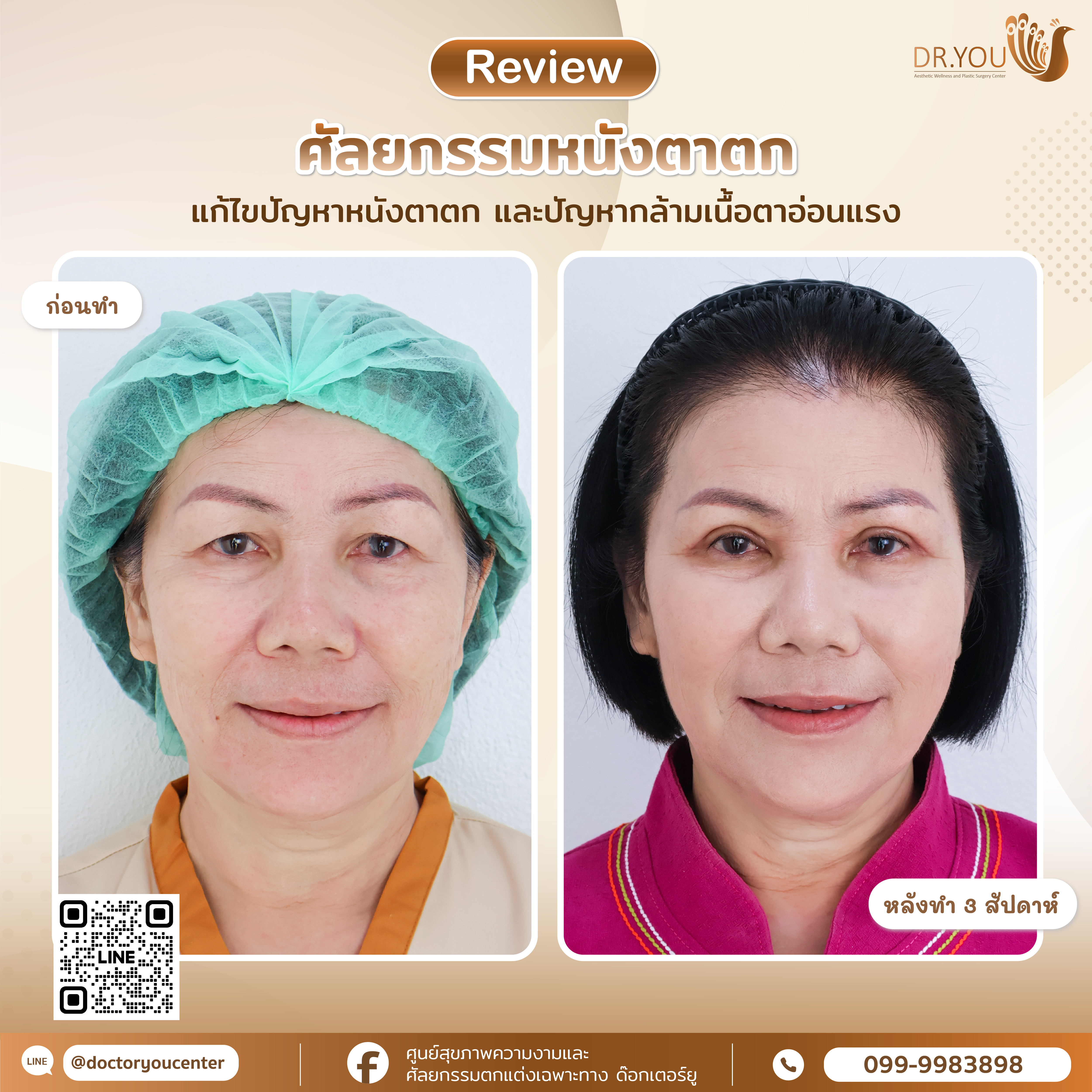 รีวิวตา2ชั้น