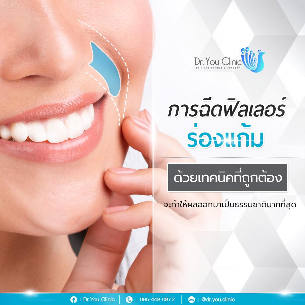 การฉีดฟิลเลอร์ร่องแก้ม