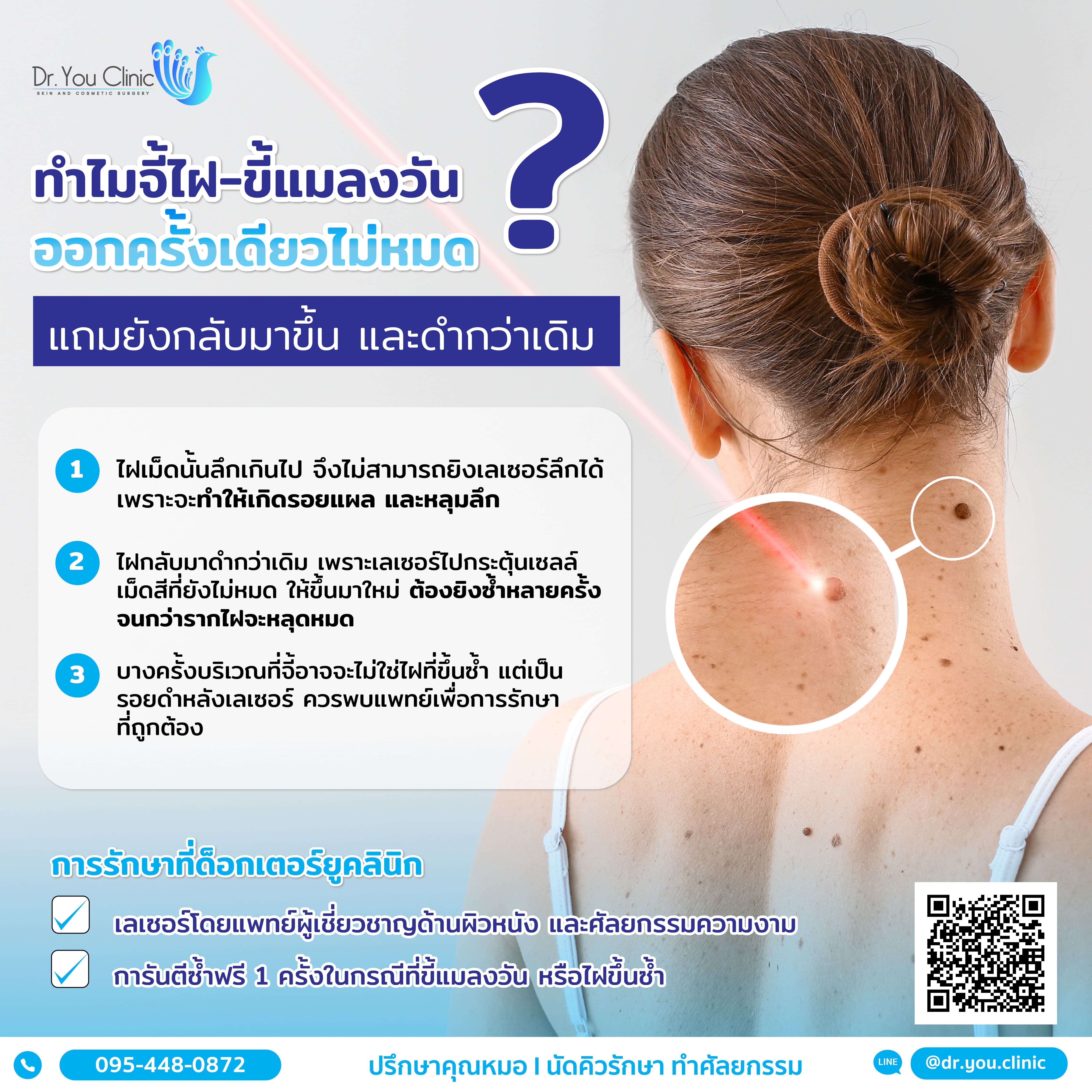 ทำไมจี้ไฝ-ขี้แมลงวันออกครั้งเดียวไม่หมด?